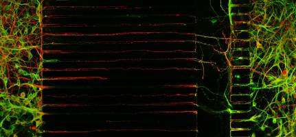 Nouvelles perspectives th�rapeutiques pour les pathologies neurod�g�n�ratives gr�ce aux v�sicules autonomes