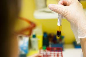 Vers une am�lioration du diagnostic de certains cancers