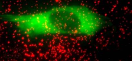 Les cellules sont-elles chatouilleuses ?