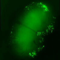 Des cultures organotypiques pour modéliser rapidement l'infection par SARS-CoV-2
