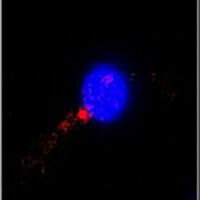 La phosphorylation de NLRP3, nouvelle cible thérapeutique contre l'inflammation ?
