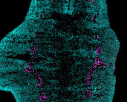 Médecine régénératrice : des scientifiques découvrent les mécanismes grâce auxquels certains vertébrés peuvent faire repousser des membres