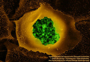 Nouvelles données d'efficacité d'un vaccin contre le méningocoque B et d'un antibiotique préventif pour réduire le risque des IST bactériennes